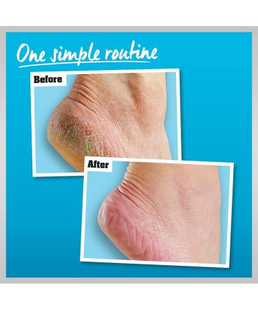 O'Keeffe's Healthy Feet Peeling & Twin Pack - 80 ml + 85 g | Best Moisturizer for Dry Cracked Feet - International Shipping Available - Buy Online on SooperMarket.com