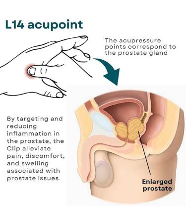 Prostate Care Point Clip Acupressure Hand Pressure Point Clip Li4 Acupressure Point Clips Long-Lasting and Reusable for Relief from Prostate Lssues (2Pcs) - Buy Online on SooperMarket.com