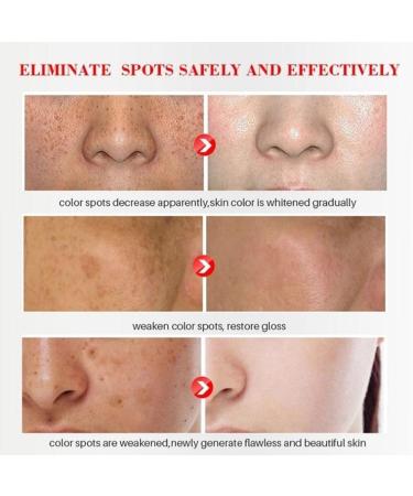 Dark Spot Remover Cream for Face, Body & Sensitive Areas - With Alpha Arbutin, Niacinamide, Collagen, Vitamin E - Powerful Age Spot Corrector - Buy Online on SooperMarket.com