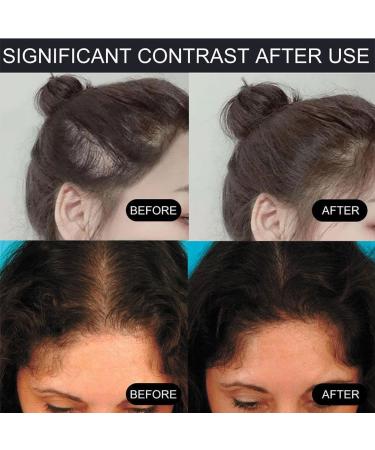 Magical Fluffy Thin Hair Powder Hair Coverage Touch Up Hair Powder Root Cover Up for Thinning Hair 4g 2pcs - Buy Online on SooperMarket.com