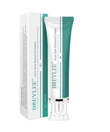 MIESCHER Acne Cream Acne Scar Removal Cream  Face Pimples Scar Stretch Marks Cream Remover Acne Removal Burn Cream Moisturizing Repair Damaged Skin Scar Away Gel Acne Scar Treatment