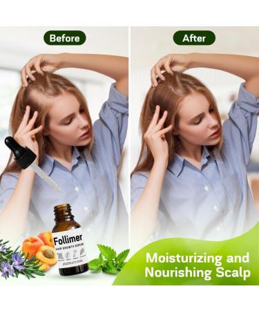 Premium Hair Growth Oil - DHT Blocker with Organic Rosemary Peppermint Pumpkin Seed & Apricot Oils | Natural Minoxidil Alternative | Made in USA - Buy Online on SooperMarket.com