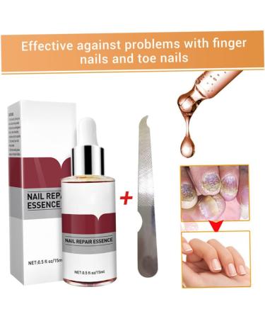 1PC Nail Treatment Nail Renewal Solution Toenails & Fingernails Nail Repairs Essential Oil Protects Toenail Fungus Treatment From Discoloration Brittle And Cracked Nail(12ML) - Buy Online on SooperMarket.com