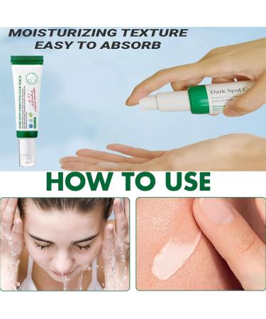 Facial Black Spot Remover Cream Facial Correction Cream Nicotinamide Facial Essence Skin Repair for Lightening Sunburn and Acne Marks Lightening Pigmentation and Rapidly Improving Skin Color 50 ml - Buy Online on SooperMarket.com