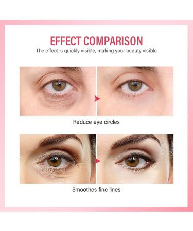 Eye Spray for Fine Lines & Dark Circles - Tighten Skin & Moisturize | International Shipping Available - Buy Online on SooperMarket.com