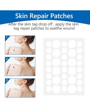 Acrochordon Treatment Kit Anti-Tick Treatment with 60 Strips of Micro and Regular Skin Labels (1mm to 9mm) for Face and Body with 36 Repair Patches - Buy Online on SooperMarket.com