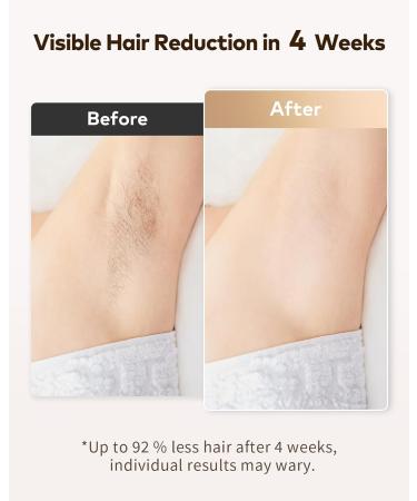 ZKMAGIC IPL Hair Removal Device - 3-in-1 with 9 Energy Levels | Pain-Free Laser Hair Removal for Men & Women | 999 900 Light Impulses | Buy Online Now! - Buy Online on SooperMarket.com