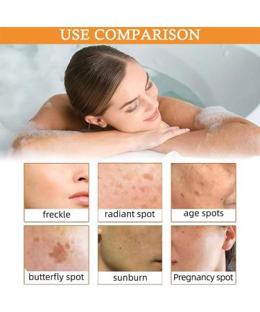 Turmeric Soap Turmeric Brightening Soap Vitamin C Soap Piece Remove Dark Stains Deep Cleansing for Face and Body - Buy Online on SooperMarket.com