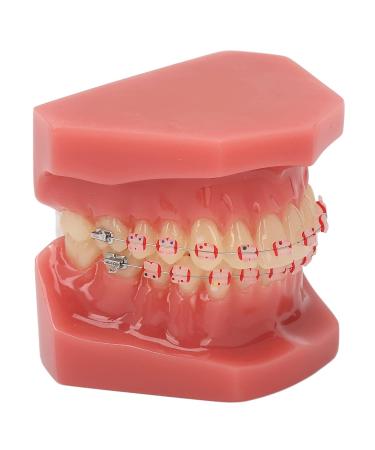 Orthodontic Demonstration Model for Dental Research | Metal Wires & Ceramic Brackets | Teaching Aids for Adults - Buy Internationally - Buy Online on SooperMarket.com