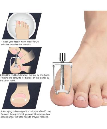 KARELLS Ingrown Toenail Correction Set Ingrown Toenails Set 12 Pieces Ingrown Toenail Lifter Ingrown Toenail Correction Treatment Set for Ingrown Toenails - Buy Online on SooperMarket.com