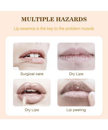 Vigcebit Lip Filler Set - 2-Part Moisturizing Lip Enhancer for Beautiful Fuller Lips | Hydrating Lip Gloss Set - Buy Online on SooperMarket.com