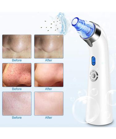 Electric Pore Extractor Tool USB Rechargeable Professional for Women Girls Vacummer Pore - Buy Online on SooperMarket.com
