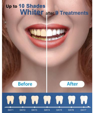 MySmile Teeth Whitening Kit with LED Light - Fast Non-Sensitive Whitener with 3 Carbamide Peroxide Gels - Remove Stains from Coffee, Smoking, Wine & Food - 10 Min Treatment - Buy Online on SooperMarket.com
