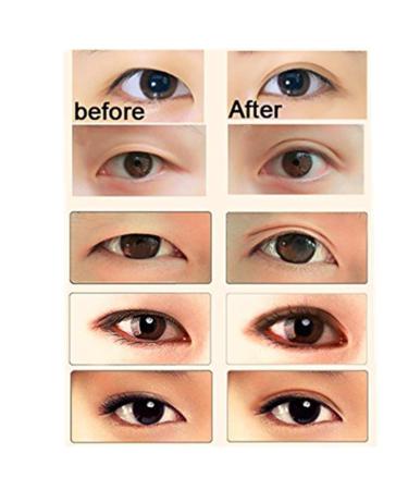 300 Pairs Adhesive Invisible Fiber Double Eyelid Tape - Waterproof Eye Tape for Natural Look with Y Shaped Fork (Slim) - International Shipping - Buy Online on SooperMarket.com