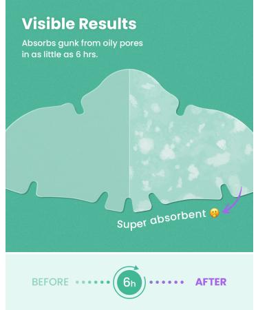 GLAM UP Spotless Nose Patch XL - Hydrocolloid Treatment for Pores, Pimples & Blackheads - 12 Patches - Buy Online on SooperMarket.com