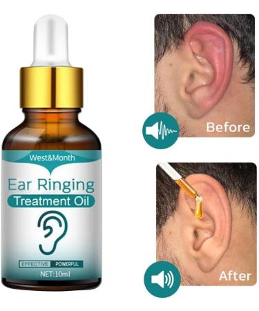 Non-Pungent Tinnitus Ear Drops - Lightweight Functional Relief Oil with Herbs - Style A Color 10ML - Buy Online on SooperMarket.com