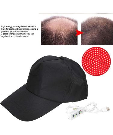 140 Laser Hair Regrowth Helmet - Effective Baldness Treatment for Men and Women - Buy Online on SooperMarket.com