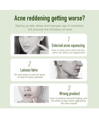 Anti Acne Removal Cream Tea Tree Acne Removal Gel Acne Cream for Acne Treatment & Spot Treatment Clear Soothing Spot Gel Acne Moisturiser Whiteheads & Blackhead Remover Invisible Gel - Buy Online on SooperMarket.com