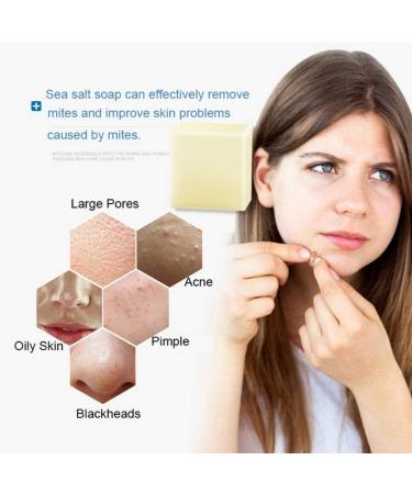 Weixinbuy Mite Soap Rich In Sea Salt Quickly Remove Mites Repair Nourish Skin Personal Care Product - Buy Online on SooperMarket.com