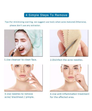 Ellolife 4-Pack Comedone Squeezer Set | Stainless Steel Blackhead Remover Kit for All Skin Types - Buy Online on SooperMarket.com