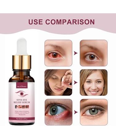 Eye Stye Remover for Fast Relief - Gentle Treatment for Styes  Chalazion  and Blepharitis - Buy Online on SooperMarket.com