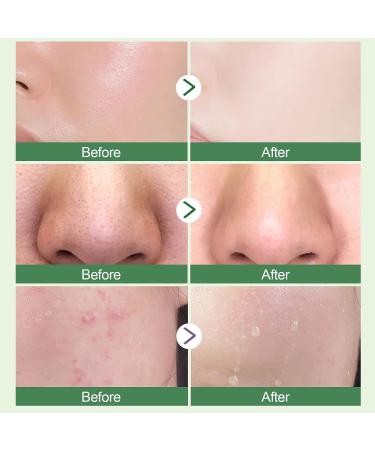 Anguishil Green Tea Mask Stick - Deep Cleanse & Oil Control for All Skin Types (1 PCS) - Buy Online on SooperMarket.com