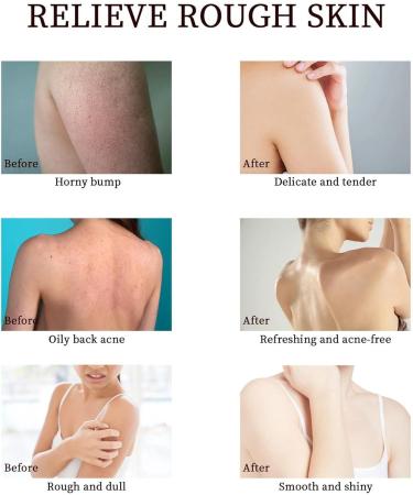 Mud Rub Gel Rose Mud Run Scrub Cream 50ml Body Exfoliator Scrub Mud Rub Gel for Skin Mud Rubbing Artifact Gel Mud Rub Cleansing Gel for Moisturizing and Deep Cleansing Cypreason - Buy Online on SooperMarket.com