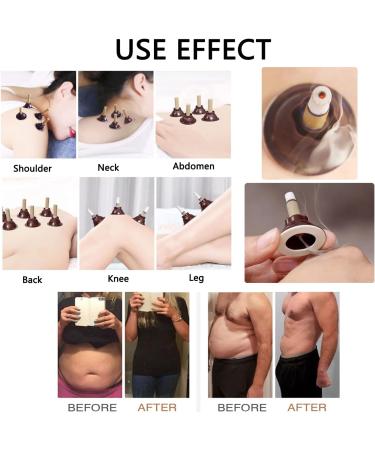 Moxa Sticks for Moxibustion Moxibustion Sticks 50/100/150Set Moxibustion Gathering Energy Burning Column Moxa Stick Moxa Box Moxa Heat Pack Moxibustion Box with Self-Stick Base (100Set) - Buy Online on SooperMarket.com
