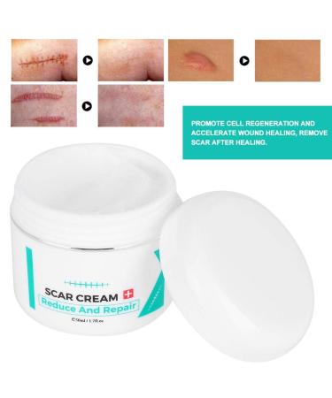 Scar Removal Cream | Stretch Marks Serum | Skin Repair Treatment - Buy Online on SooperMarket.com