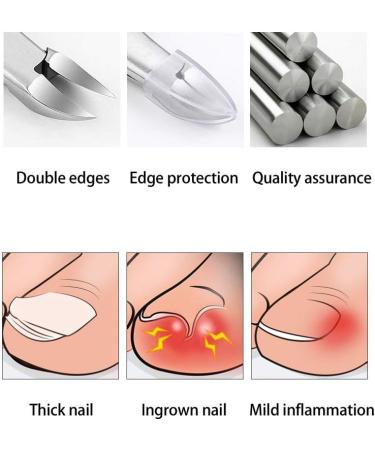 Pedicure Scissors Pedicure Scissors Nail Clippers ingrown toenail Clippers Tool for Men and Women Removal of Dead Skin Premium Stainless Steel Nail Pliers (F1) - Buy Online on SooperMarket.com