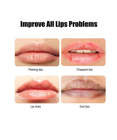 VERONNI 24K Gold Lip Mask - Hydrating Lip Plumper with 30 Patches for Smoother, Firmer Lips - Moisturizing and Nourishing Formula to Minimize Fine Lines - Buy Online on SooperMarket.com