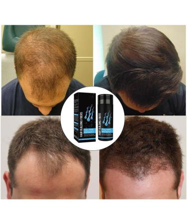 Hair Building Fibers Hair Building Fibres Powder Hair Fibres Dark Brown Hair Fibres For Thinning Hair Hair Loss Concealer Fiber Hair Building Fibres & Hair Fibers (Dark Brown) - Buy Online on SooperMarket.com