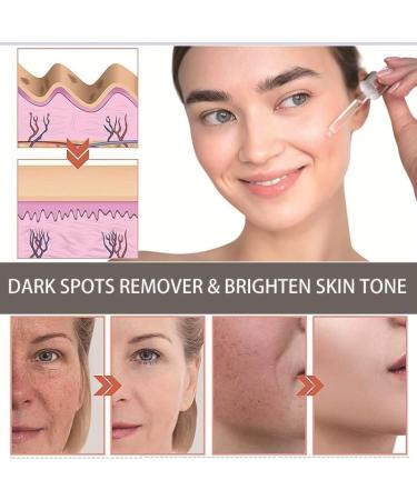 Retinol Serum For Face/Neck/Eyes - Retinol 1% in Squalane 30ml - High-Strength Face Serum for Activate Skin- Anti Aging Facial Serum for Moisturizing Fine Line Skin Repair - Buy Online on SooperMarket.com