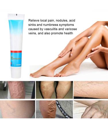 Varicose Vein Treatment Cream - Reduce Inflammation, Improve Circulation | Vein Lotion for Legs & Body - Buy Online on SooperMarket.com