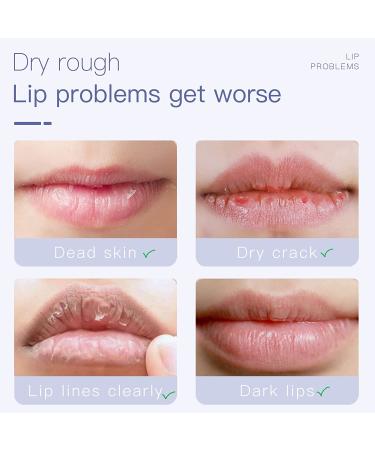 Lip Exfoliator Scrub for Dark and Chapped Lips - Gentle Treatment with Moisturizing Benefits - Buy Online on SooperMarket.com