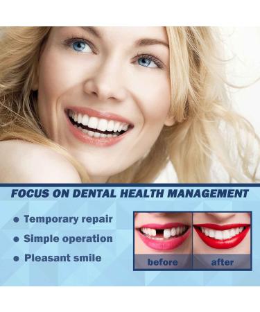 Provisional Denture Kit - Formable Tooth Repair Set for Missing Teeth | 3PCs Prosthesis Dental Care Tools - Buy Online on SooperMarket.com