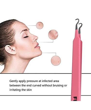 FEITA Pro Blackhead Acne Extraction Tweezers - Surgical-Grade Stainless Steel Curved Comedone Extractor for Whitehead & Pimple Removal - Pink - Buy Online on SooperMarket.com