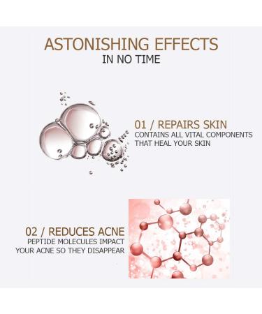 VENZEN Natural Organic Advanced Repair Skin Hyaluronic Solution 30ml | Hydrating Nicotinamide & Oligopeptide - International Shipping Available - Buy Online on SooperMarket.com