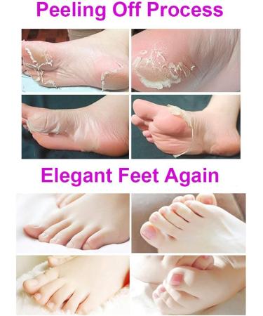 Exfoliating Foot Peel Mask - 2 Pairs | Remove Dead Skin in 3-7 Days | Lavender Scented Foot Mask for Soft Feet - Buy Online on SooperMarket.com