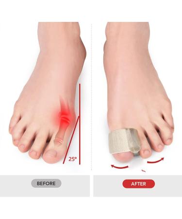 Professional Toe Corrector Set - 6 Pairs, Skin-Friendly & Elastic SEBS Belt for Bunions & Yoga - Buy Online on SooperMarket.com