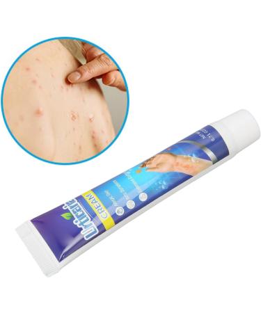 20g Anti-Itch Cream for Urticaria & Pruritus | Adjunctive Treatment for Dry Skin | Soothes Hives & E45 Itch Relief - Buy Online on SooperMarket.com