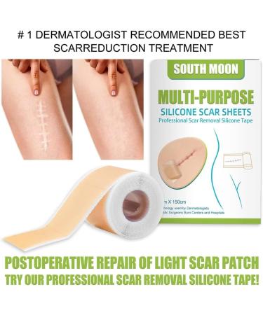 Silicone Scar Gel Strip - Efficient Scar Treatment for Surgery, Acne & Trauma - 4 * 150cm - Buy Online on SooperMarket.com