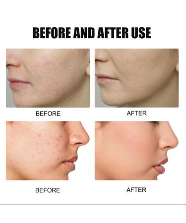 Rozino 3PC Face Serum Set | Advanced Collagen Boost Anti-Aging Solution for Glowing Skin - Buy Online on SooperMarket.com