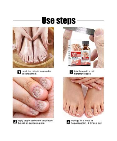 Buy Tlopa Nail Growth and Strengthening Serum - Nail Repair Solution (2 Pieces) for Stronger Healthier Nails Worldwide - Buy Online on SooperMarket.com
