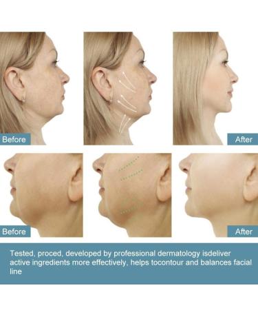 V-Line Masks | V Face Thin Mask for Chin Contour & Anti-Aging | Firming Moisturizing & Wrinkle Reduction - Buy Online on SooperMarket.com