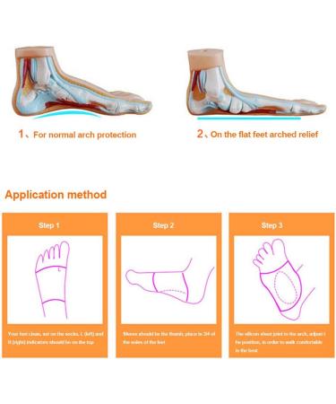 KONMED Foot Cuff Orthosis for Flat Feet Correction - Silicone Sole Pad - 1 Pair - Buy Online on SooperMarket.com