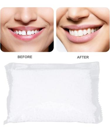 Temporary Dental Repairs - 100g Thermal Fitting Beads for False Teeth & Tooth Filling - Perfect for Halloween Parties - Buy Online on SooperMarket.com