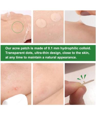 Acne Healing Patch Acne Absorbing Cover Invisible Skin Acne Treatment Stickers for Facial 24Patches acne treatment - Buy Online on SooperMarket.com