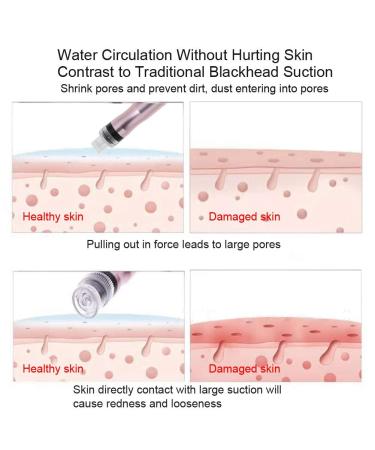 Portable Oxygen Spray Beauty Machine for Blackhead Clean and Skin Rejuvenation - Buy Online on SooperMarket.com