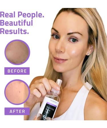 YEOUTH Balancing Facial Toner Spray with Chamomile - Hydrating Anti-Aging Toner for Face Wrinkles, Pores, Dull Skin & Dark Spots - 3.38 Fl Oz - Buy Online on SooperMarket.com